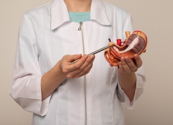 médica apontando para uma maquete de estômago. Conceito de cirurgia bariátrica