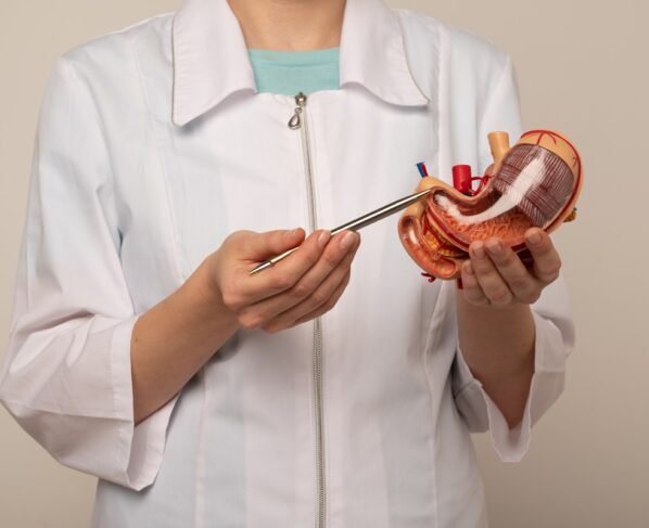 médica apontando para uma maquete de estômago. Conceito de cirurgia bariátrica