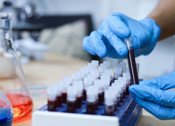 Pesquisa de sangue, mão de cientista segurando tubo de ensaio com sangue em laboratório. Metrópoles