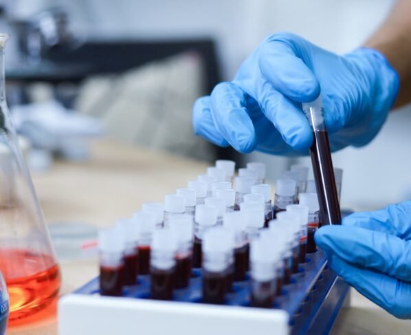 Pesquisa de sangue, mão de cientista segurando tubo de ensaio com sangue em laboratório. Metrópoles