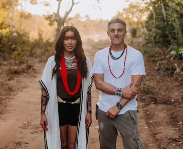 Anitta explica nova plástica, se irrita com críticas e desabafa - destaque galeria