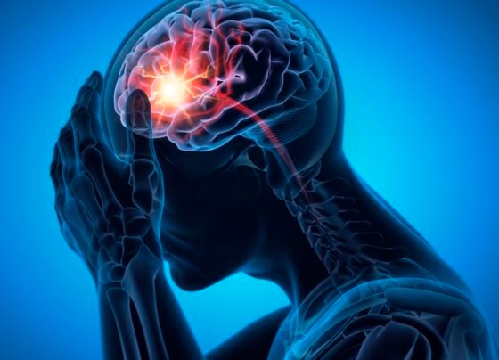 Ilustração de homem com forte dor de cabeça - Saiba como reduzir o risco de AVC e cuidados essenciais para prevenção - Metrópoles