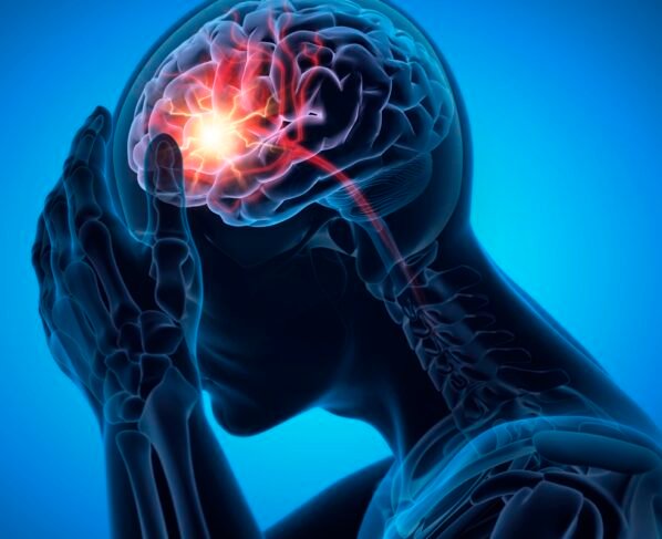 Ilustração de homem com forte dor de cabeça - Saiba como reduzir o risco de AVC e cuidados essenciais para prevenção - Metrópoles