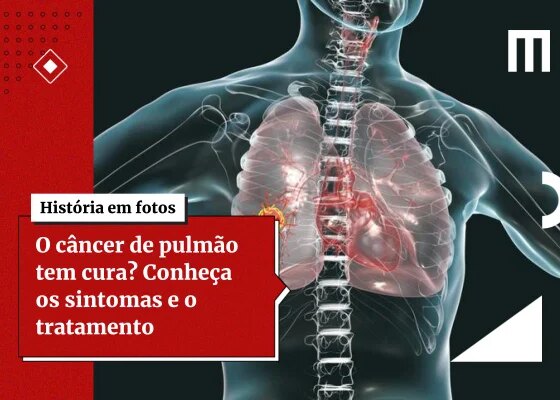Exame de sangue pode antecipar diagnóstico do câncer de pulmão - destaque galeria