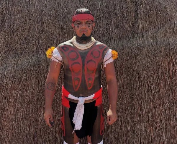 Jovem indígena espera cirurgia de urgência no DF e situação se agrava - destaque galeria