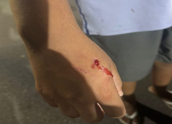 Morador grava PMs atirando e matando pit-bulls que atacaram criança - destaque galeria