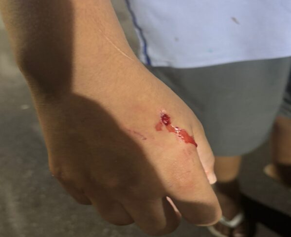 Morador grava PMs atirando e matando pit-bulls que atacaram criança - destaque galeria