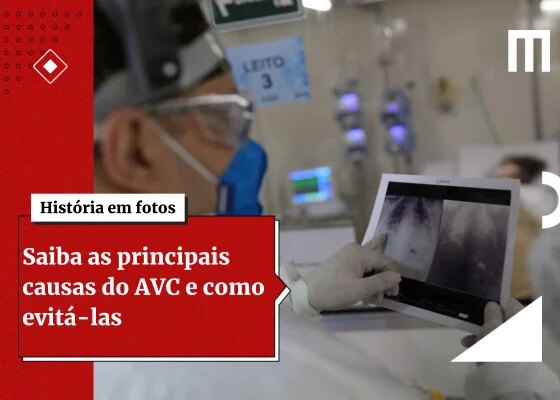 Neurologistas listam 4 hábitos que ajudam a reduzir o risco de AVC - destaque galeria