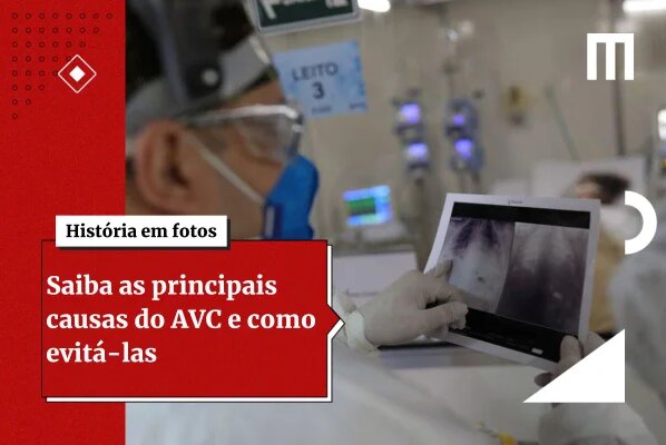 Neurologistas listam 4 hábitos que ajudam a reduzir o risco de AVC - destaque galeria