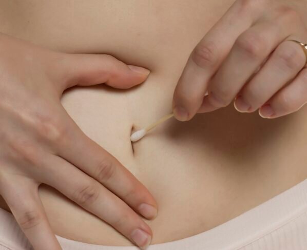 Foto colorida de pessoa limpando o umbigo com haste flexível - Médicos explicam os principais riscos de não limpar o umbigo - Metrópoles