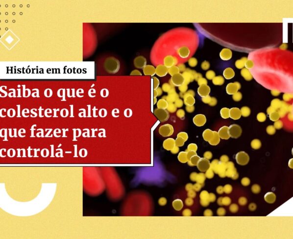 Especialistas indicam 7 melhores alimentos para reduzir o colesterol - destaque galeria