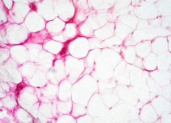 Tecido adiposo humano visto ao microscópio para fins educacionais de fisiologia. Queima de calorias. Metrópoles