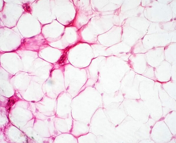 Tecido adiposo humano visto ao microscópio para fins educacionais de fisiologia. Queima de calorias. Metrópoles