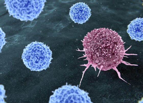 Ilustração representando a terapia com linfócitos infiltrantes de tumor (TIL) para o tratamento do câncer. Durante a terapia com TIL, células T (azuis) que reconhecem células tumorais (vermelhas) são obtidas do paciente. Metrópoles