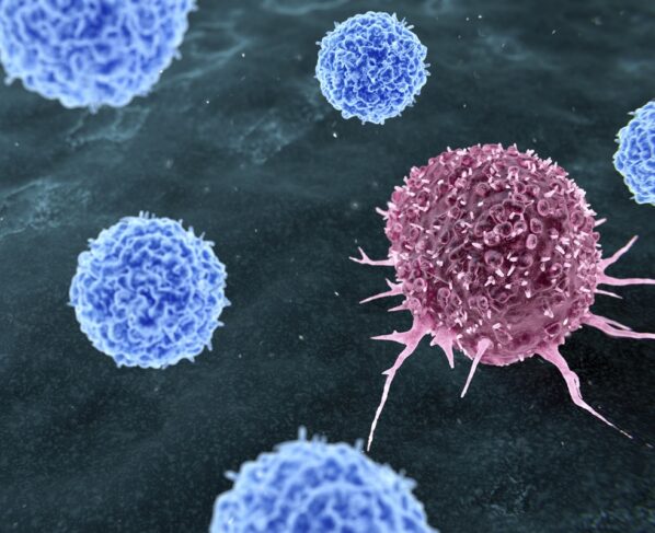 Ilustração representando a terapia com linfócitos infiltrantes de tumor (TIL) para o tratamento do câncer. Durante a terapia com TIL, células T (azuis) que reconhecem células tumorais (vermelhas) são obtidas do paciente. Metrópoles