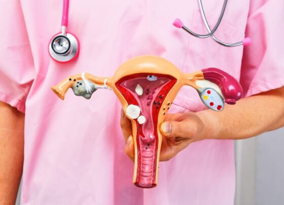 Cirurgião segurando modelo anatômico de patologias comuns. Conceito de câncer ou endometriose. Metrópoles