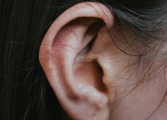 Imagem colorida de uma orelha de uma pessoa branca - Metrópoles