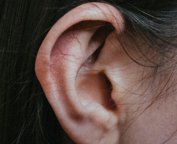 Imagem colorida de uma orelha de uma pessoa branca - Metrópoles
