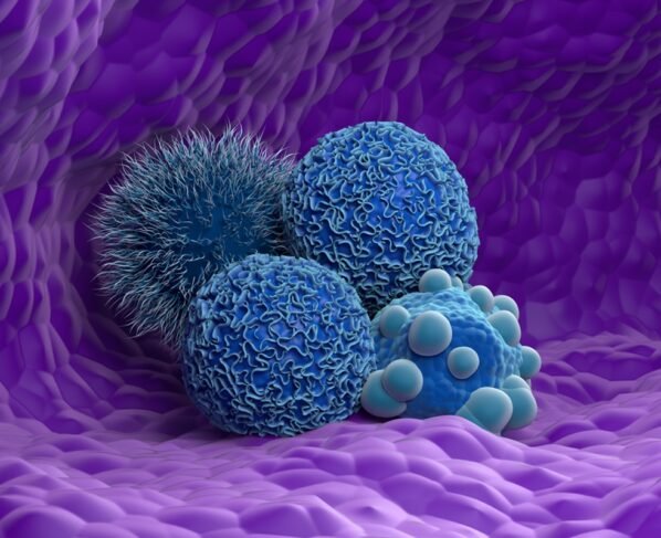 Ilustração mostra células cancerígenas em azul, em um fundo roxo - Metrópoles