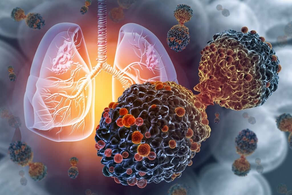 Ilustração de vírus atacando os pulmões humanos - Oncologistas explicam os principais sintomas do câncer de pulmão - Metrópoles