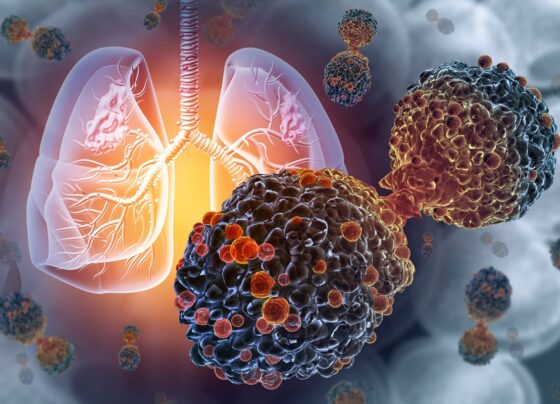Ilustração de vírus atacando os pulmões humanos - Oncologistas explicam os principais sintomas do câncer de pulmão - Metrópoles