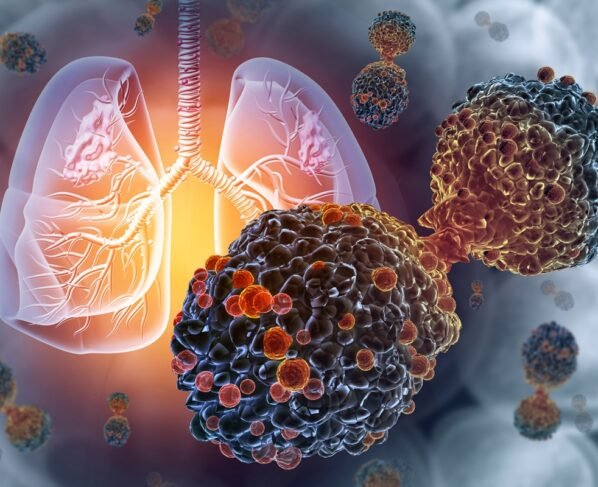 Ilustração de vírus atacando os pulmões humanos - Oncologistas explicam os principais sintomas do câncer de pulmão - Metrópoles