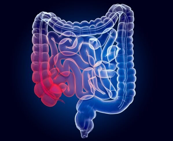 Ilustração colorida de intestino - Rastreio amplia diagnóstico precoce de câncer colorretal, diz estudo - Metrópoles